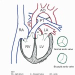 Normal Heart Anatomy